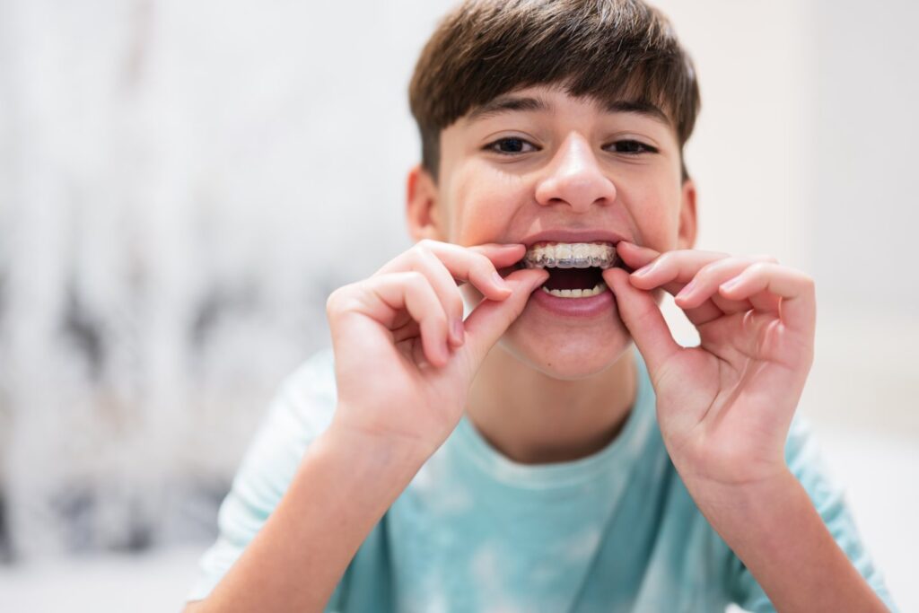 Invisalign Fall Invisalign Treatment FAQ in Post Falls ID